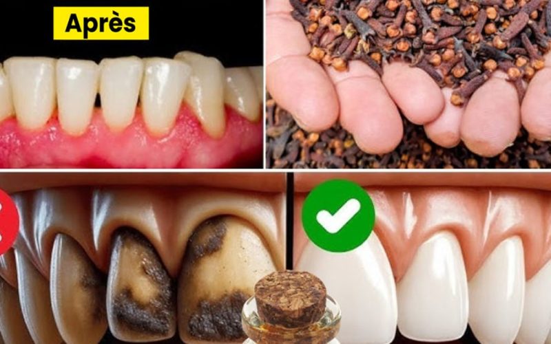 9 prírodných prostriedkov pre zdravé zuby a svieže ústa každý deň